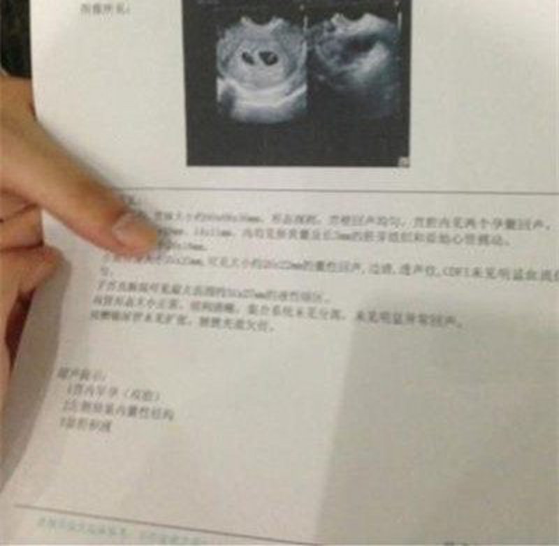 无痛胎儿亲子鉴定:科技如何让爱更安心